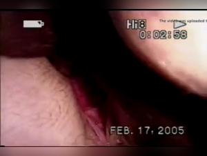 Extreme Sex Video with a Hairy Woman and a Dog