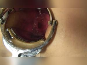 Bestiality and extreme: a female and a speculum